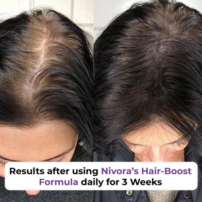 Scalp Boost Therapy by Nuvira™