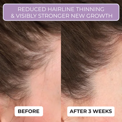 Scalp Boost Therapy by Nuvira™