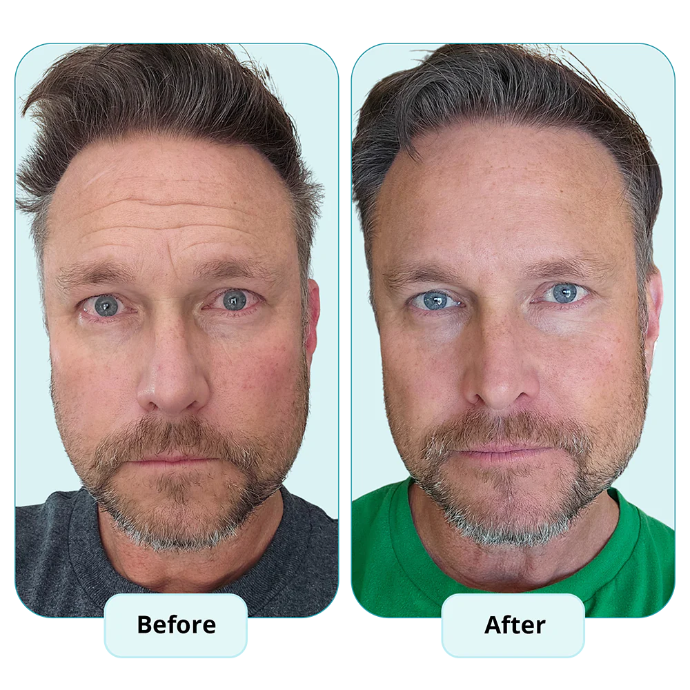 Tallowick™ The All-In-One Male SkinCare