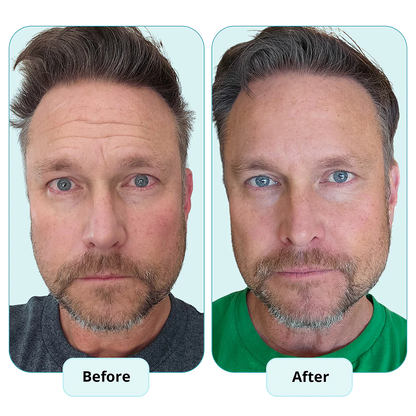 Tallowick™ The All-In-One Male SkinCare