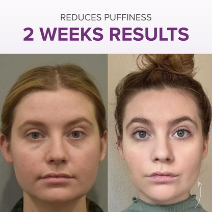 VitalRoll Sculptor + Free Serum