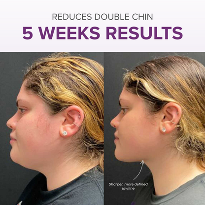 VitalRoll Sculptor + Free Serum