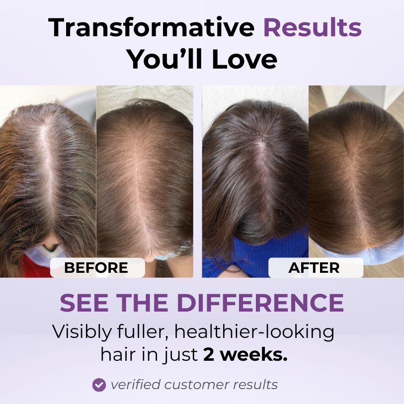 Scalp Boost Therapy by Nuvira™