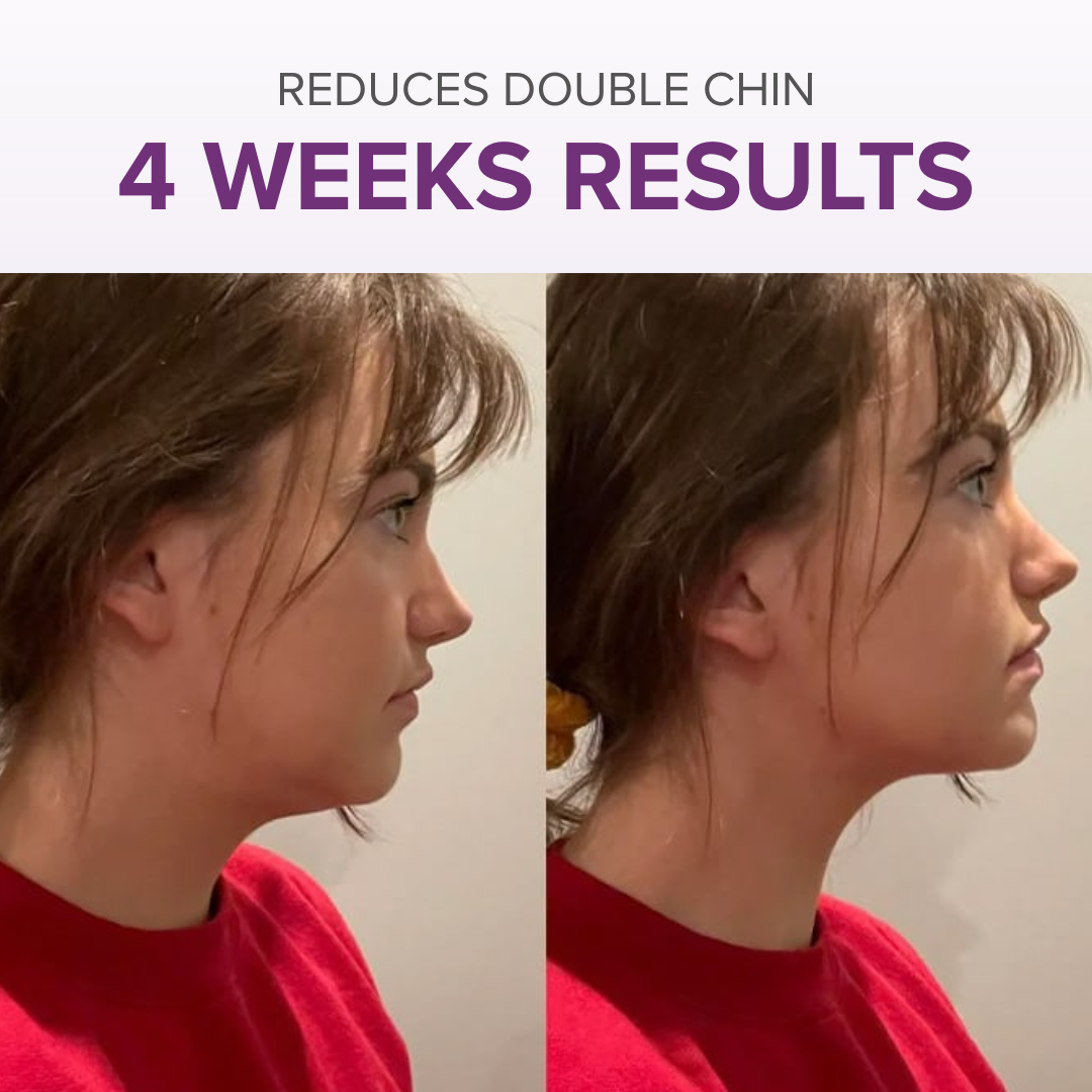 VitalRoll Sculptor + Free Serum